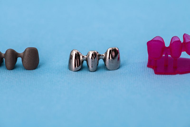 Reduction coping dental add-on